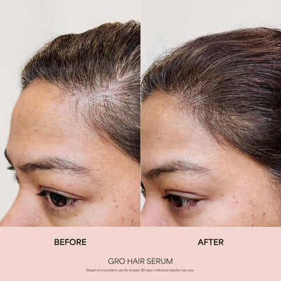 360° Hair Reboot System